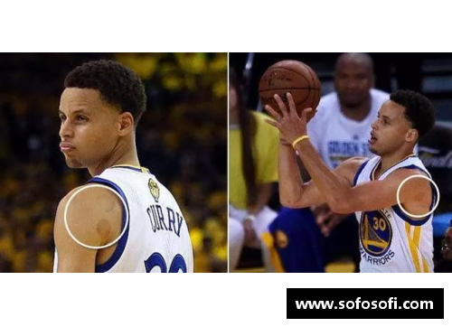 火狐全站NBA球员拔火罐：健康潮流还是趋势风险？